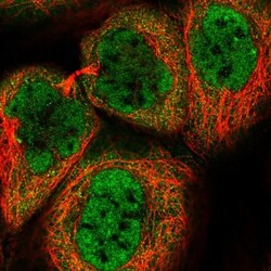 S5a/Angiocidin Antibody, Novus Biologicals:Antibodies:Primary Antibodies
